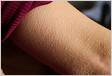 What Causes Goosebumps on Skin 4 Known Causes of Goosebumps
